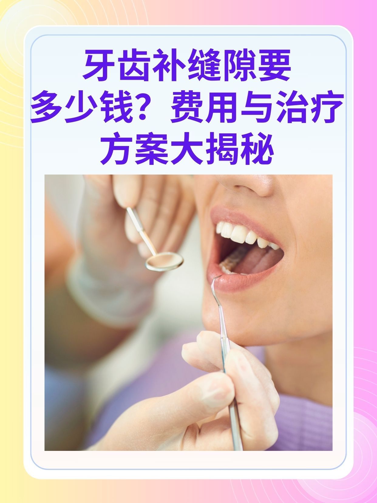 南通补牙医保可以报销吗(补牙医保可以报销吗 哪些可以报销呢)